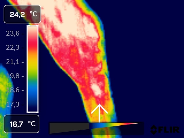 zobrazowanie termograficzne prawej kończyny miednicznej (część przyśrodkowa) - staw skokowy