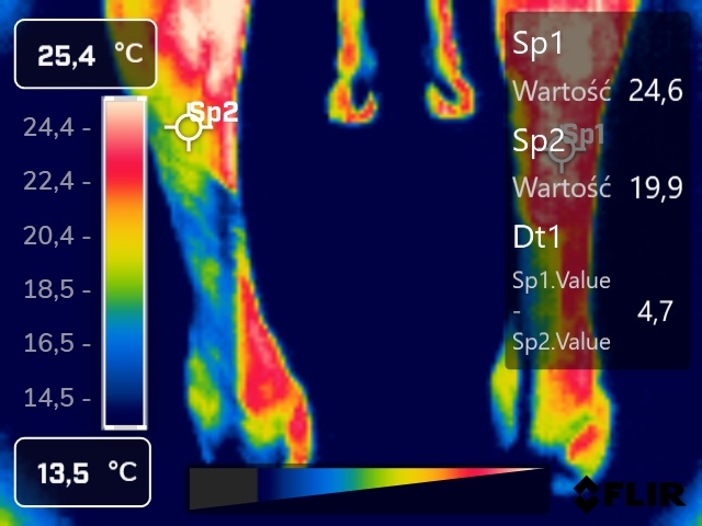 zobrazowanie termograficzne podeszwowe kończyn miednicznych
