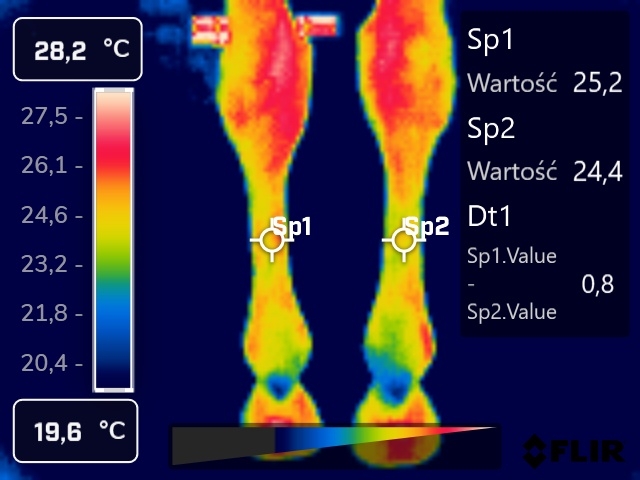 zobrazowanie termograficzne dłoniowe kończyn piersiowych