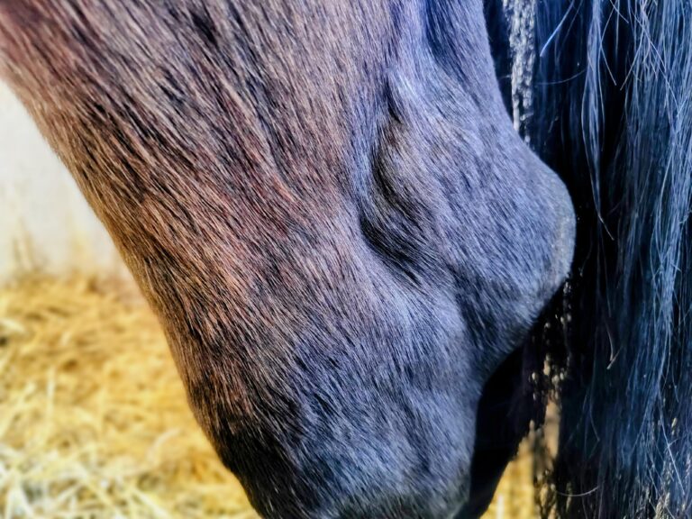 staw skokowy z opuchlizną