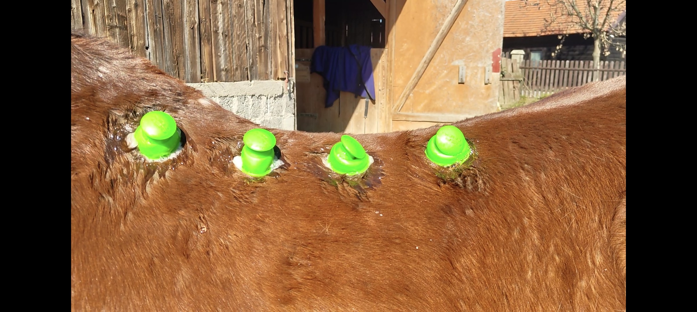 bańki chińskie w czasie aplikacji na mięsień najdłuższy grzbietu