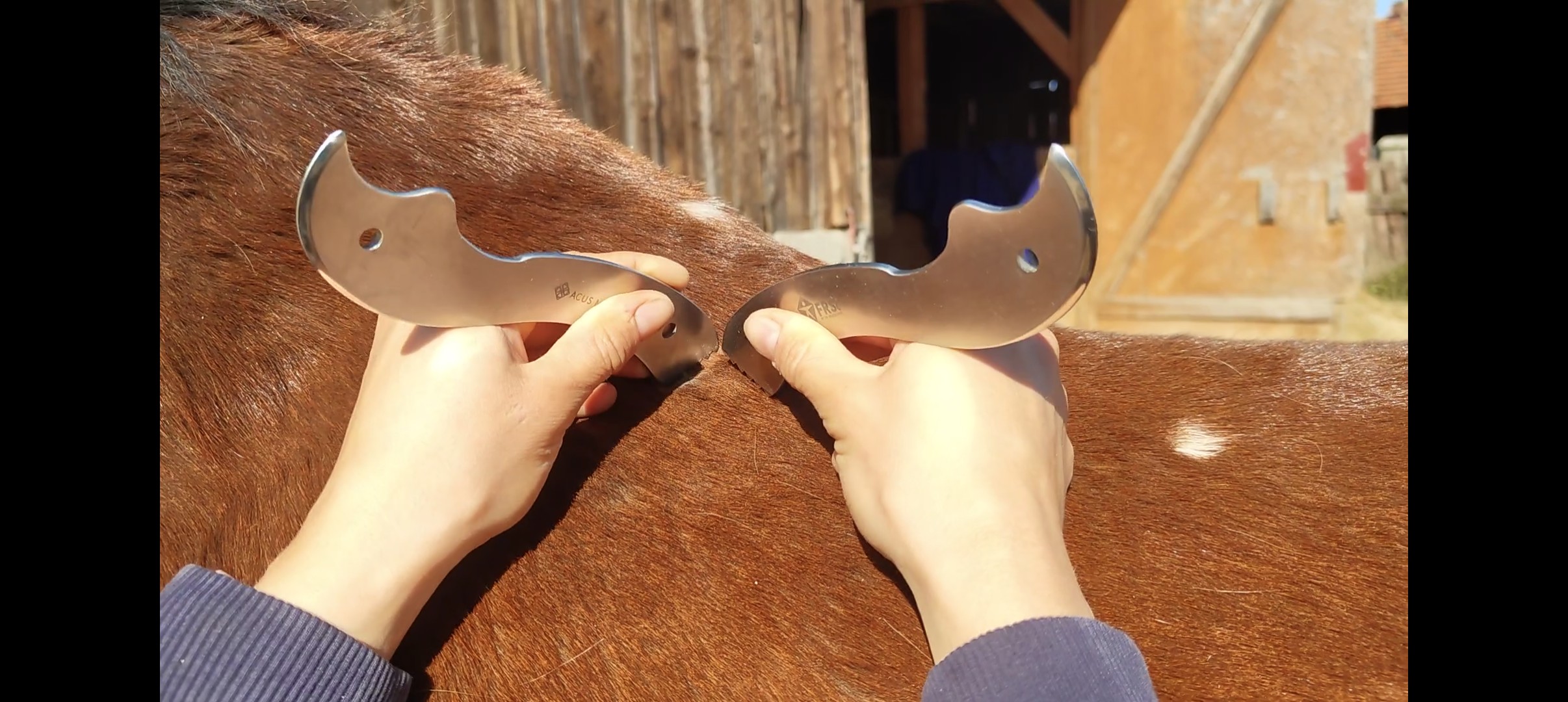 "widelcowanie" mięśnia najdłuższego grzbietu